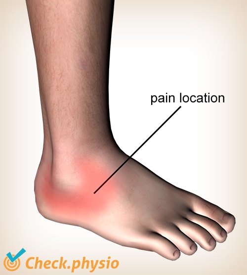 Lateral ankle ligament injury Physio Check